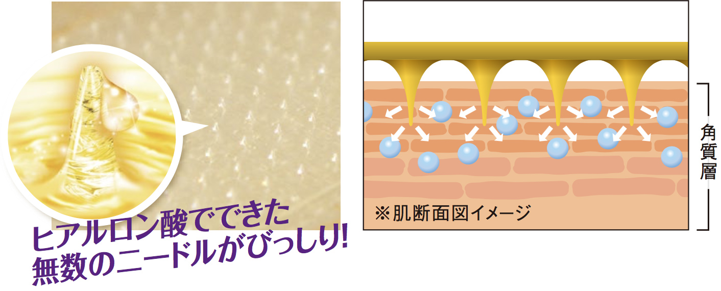 ヒアルロン酸でできた無数のニードルがびっしり！